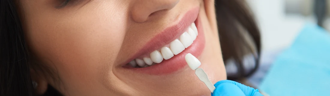 A dentist compares a fake tooth to a smiling patient’s teeth.