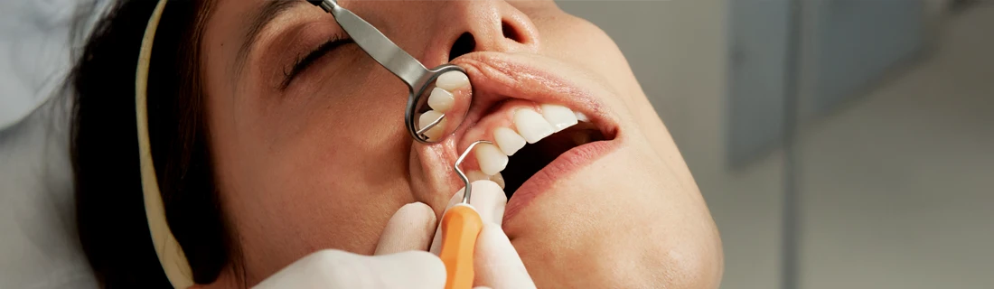A dentist using a small mirror to view a persons teeth.